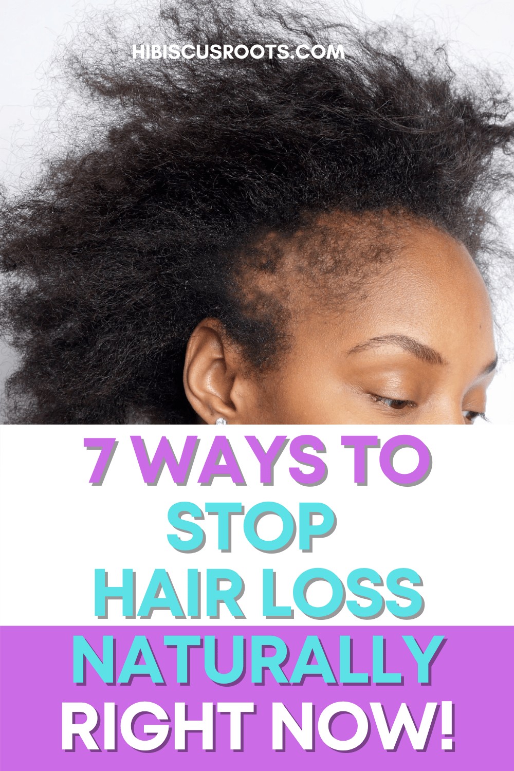 Is Your Hair Falling Out? Here’s What Might be Causing It.
