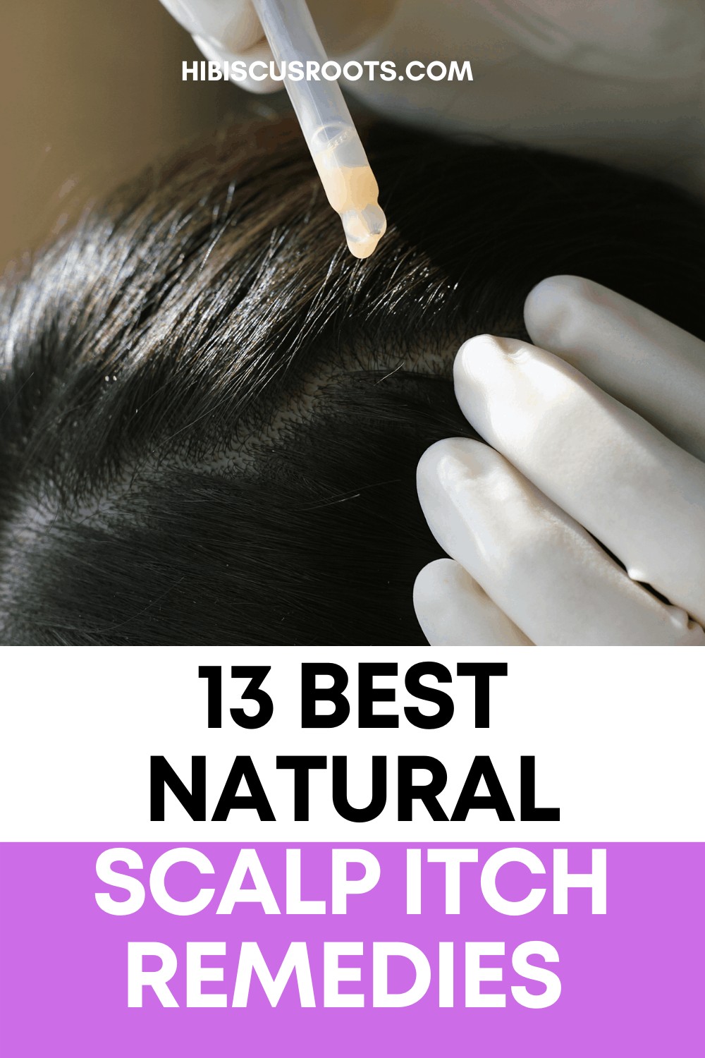 13 Natural Itchy Scalp Home Remedies for Instant Relief!